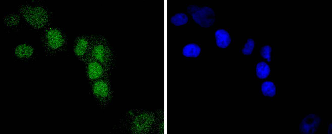 IRF2 Rabbit mAb