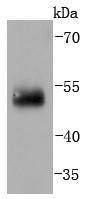 IRF2 Rabbit mAb