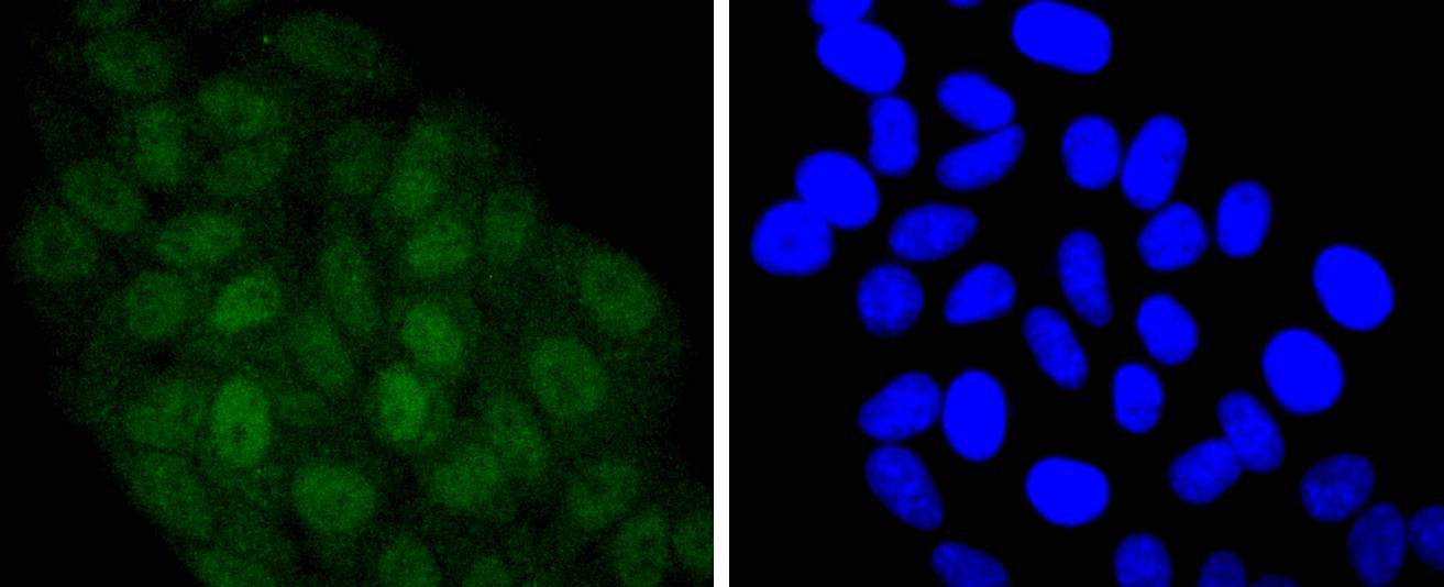 STAT 5A+B Rabbit mAb