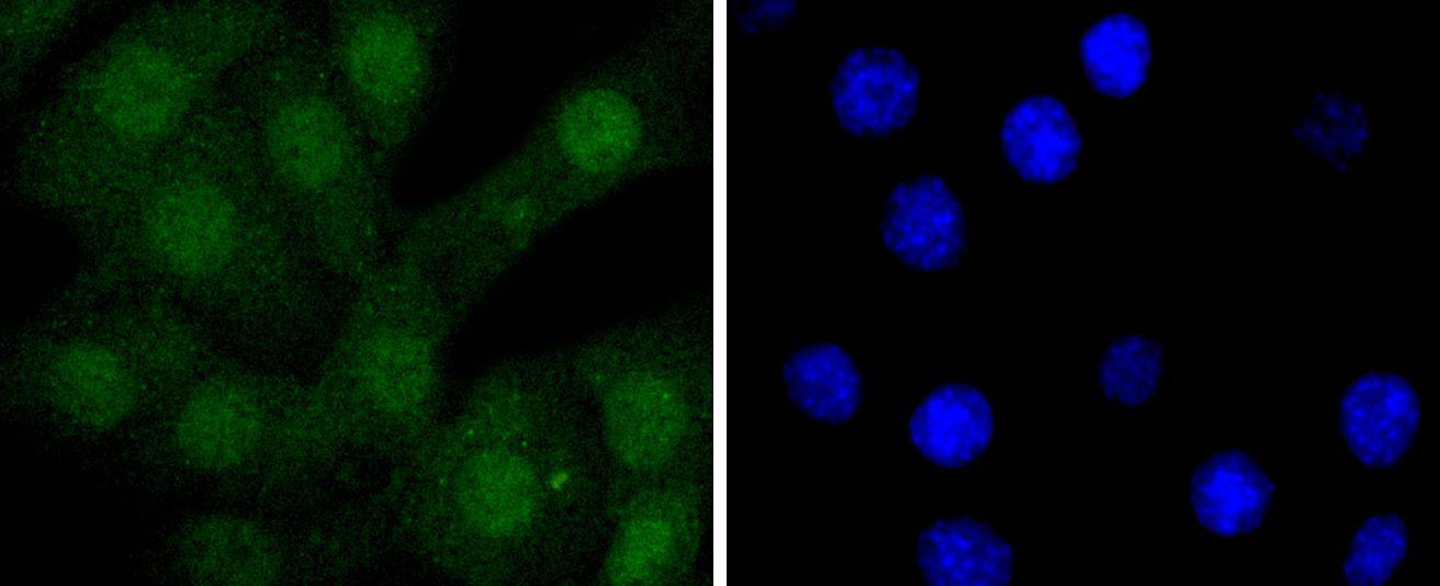 STAT 5A+B Rabbit mAb