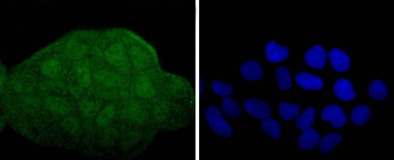 MEK3+MEK6 Rabbit mAb