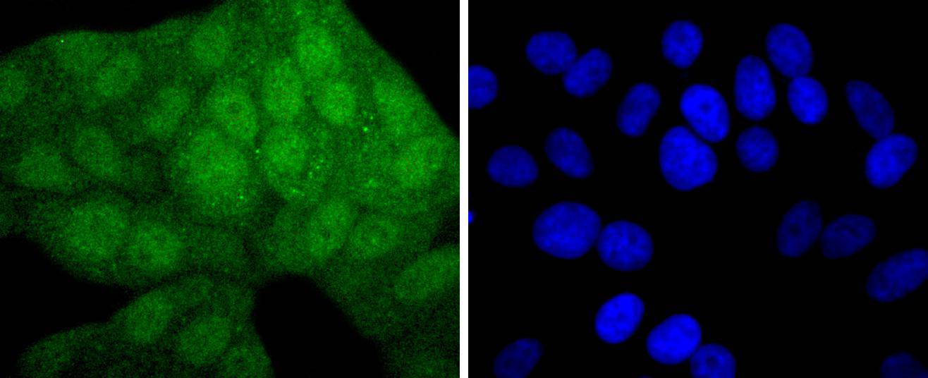 MEK3+MEK6 Rabbit mAb