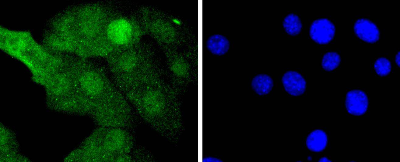 MEK3+MEK6 Rabbit mAb