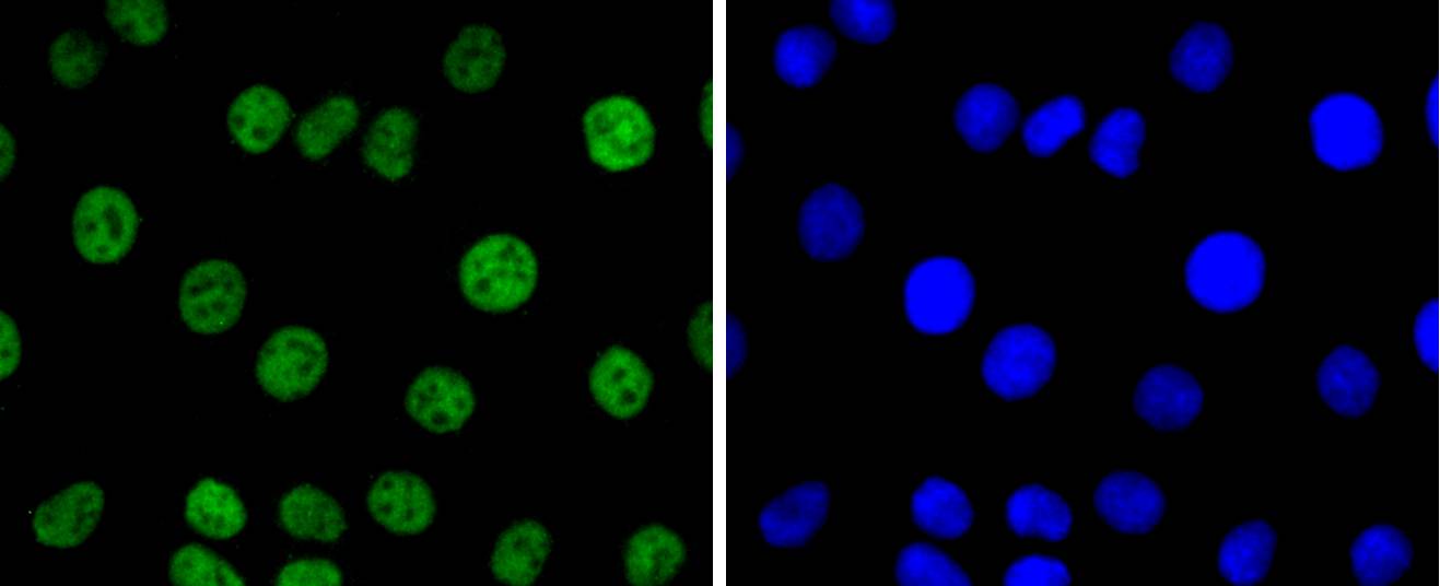 PAX8 Rabbit mAb