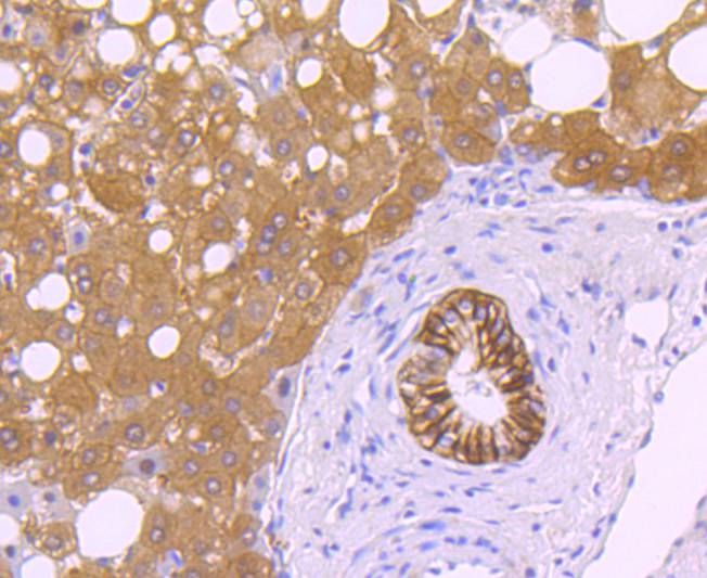 Carbonic anhydrase 9 Rabbit mAb