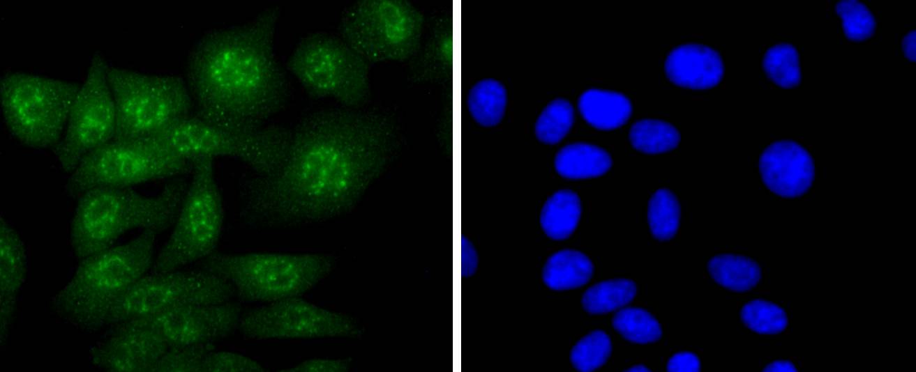 Caspase-14 Rabbit mAb