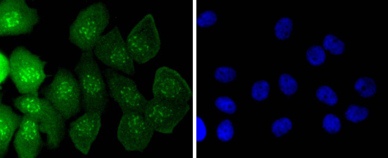 Caspase-14 Rabbit mAb