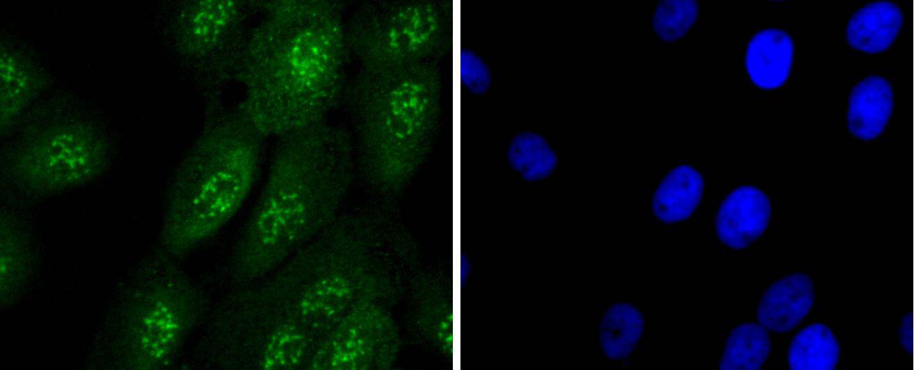 Caspase-14 Rabbit mAb