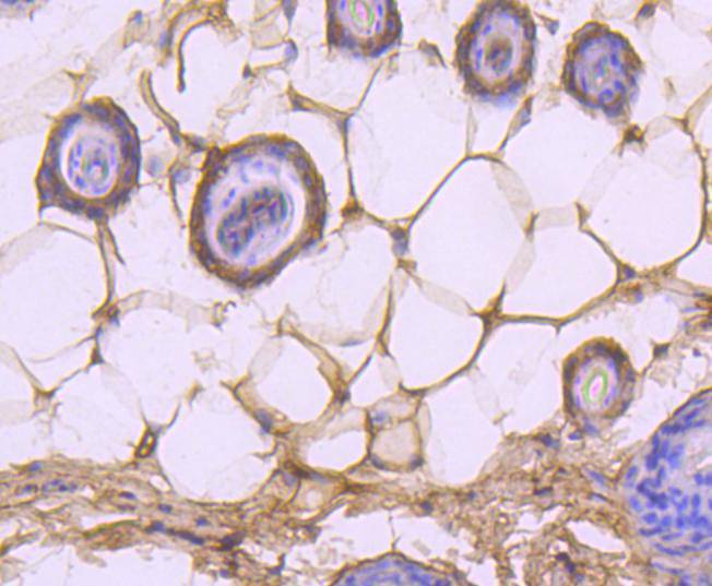 Caspase-14 Rabbit mAb