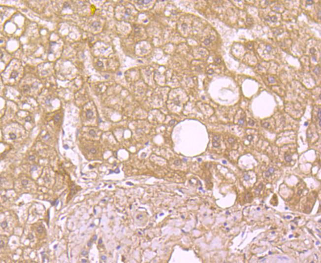 SOD2 Rabbit mAb