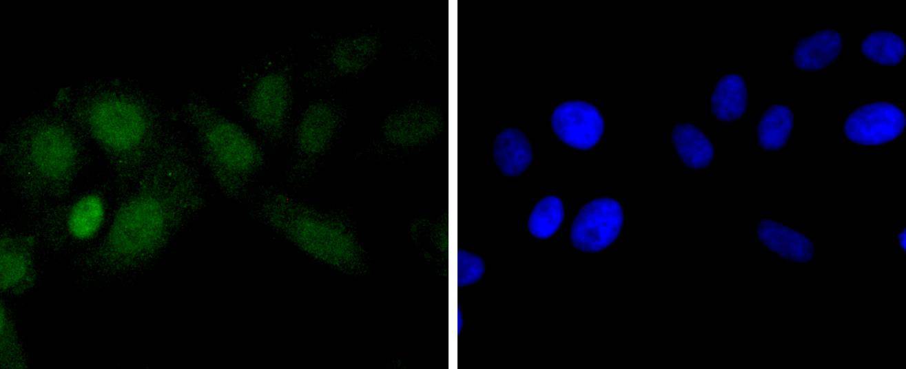 KMT6/EZH2 Rabbit mAb