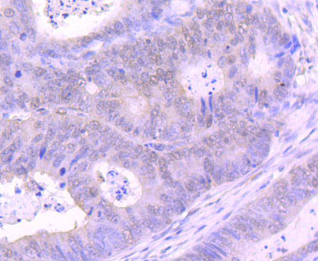 KMT6/EZH2 Rabbit mAb