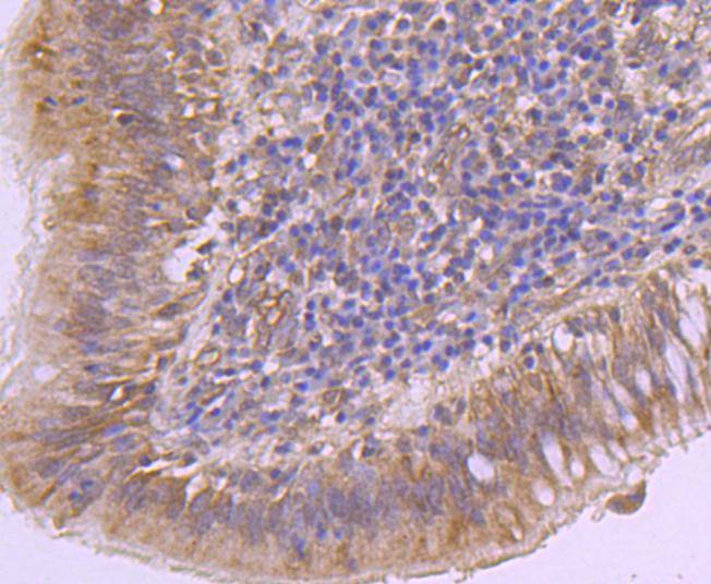 KMT6/EZH2 Rabbit mAb