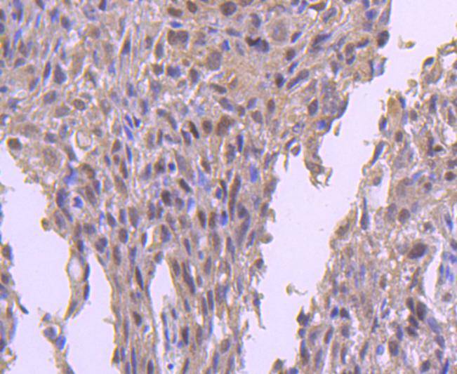 KMT6/EZH2 Rabbit mAb