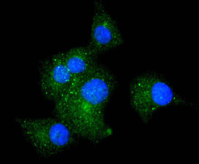 Integrin alpha 5 Rabbit mAb