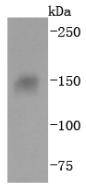 Integrin alpha 5 Rabbit mAb