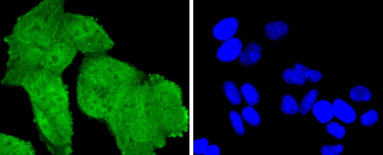 TSG101 Rabbit mAb