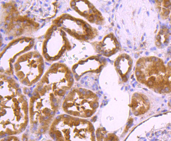 TSG101 Rabbit mAb