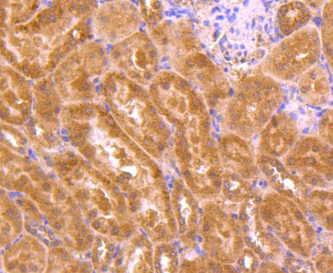 TSG101 Rabbit mAb