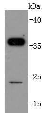 SIRT5 Rabbit mAb