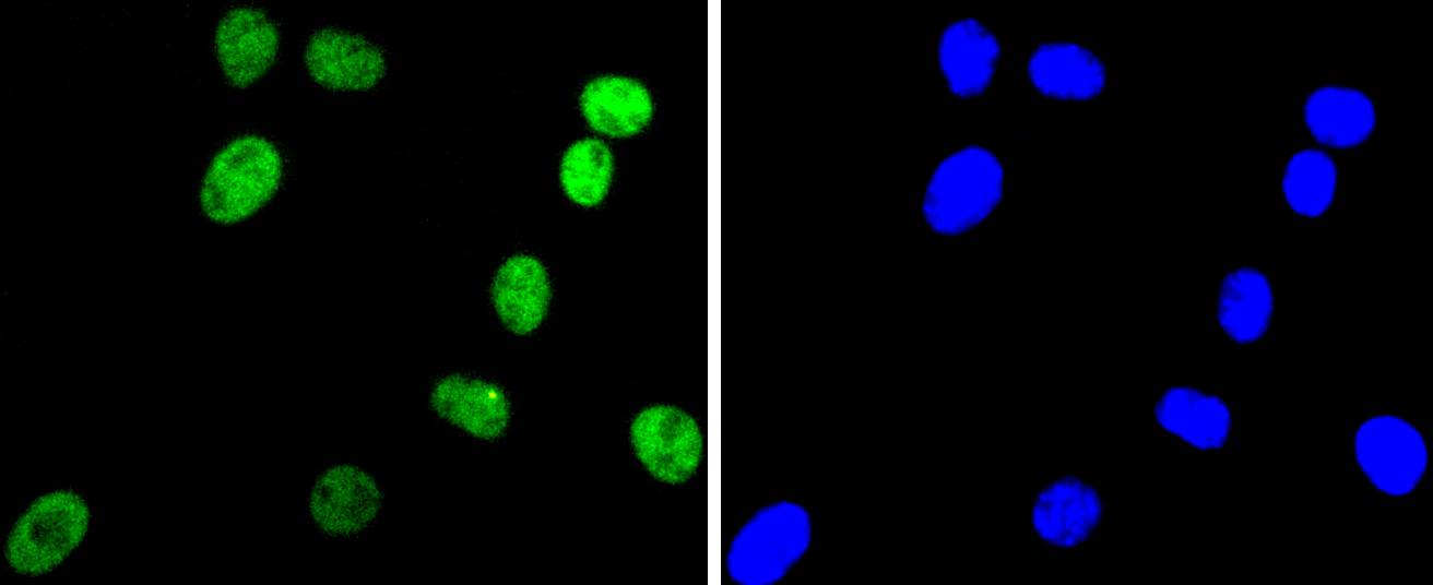 ARID1A Rabbit mAb