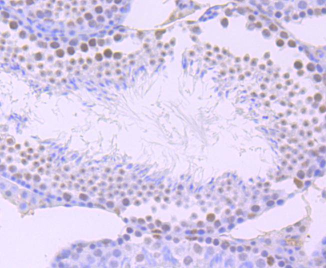 ARID1A Rabbit mAb