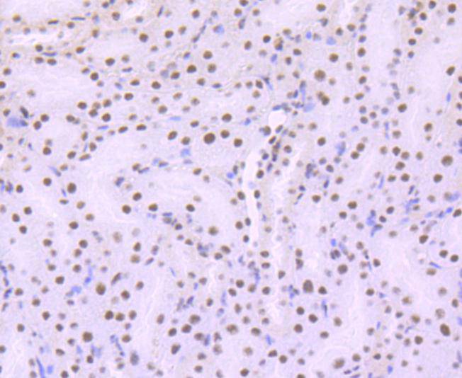 ARID1A Rabbit mAb