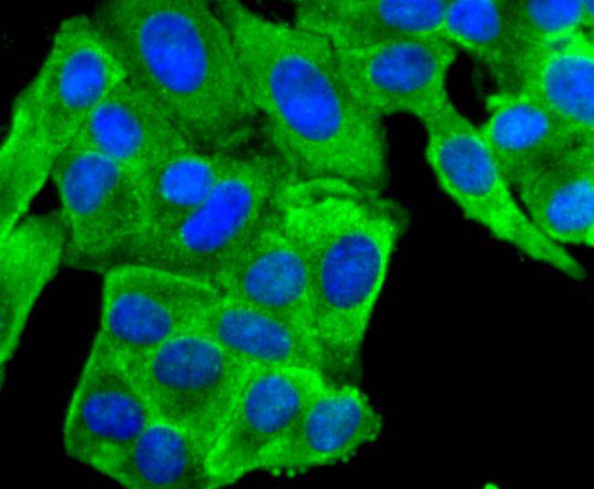 Peroxiredoxin 2 Rabbit mAb