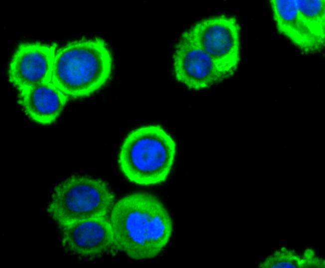 Peroxiredoxin 2 Rabbit mAb