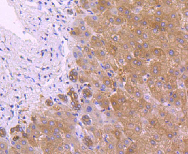 Peroxiredoxin 2 Rabbit mAb