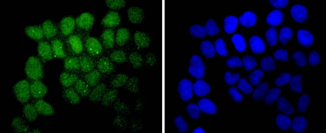 SUZ12 Rabbit mAb