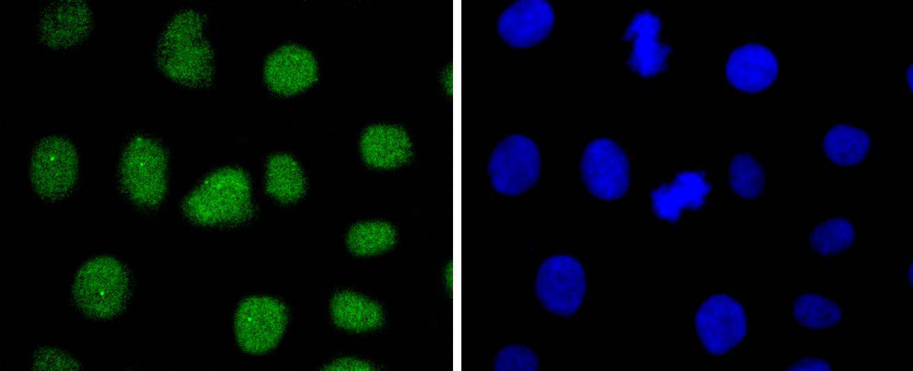 SUZ12 Rabbit mAb