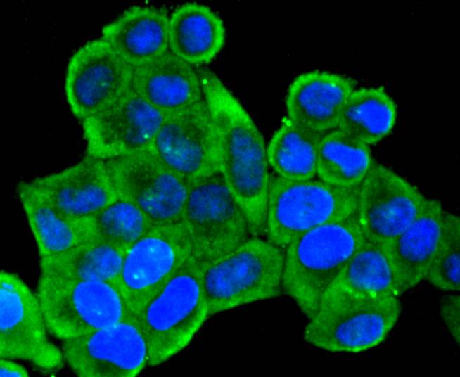 mGluR2 Rabbit mAb