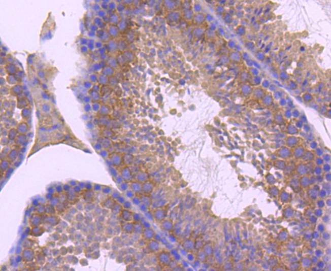 ZNRF2 Rabbit mAb