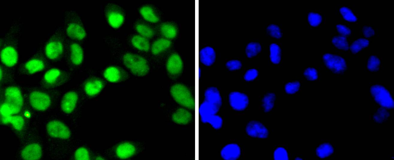 SUMO4 Rabbit mAb