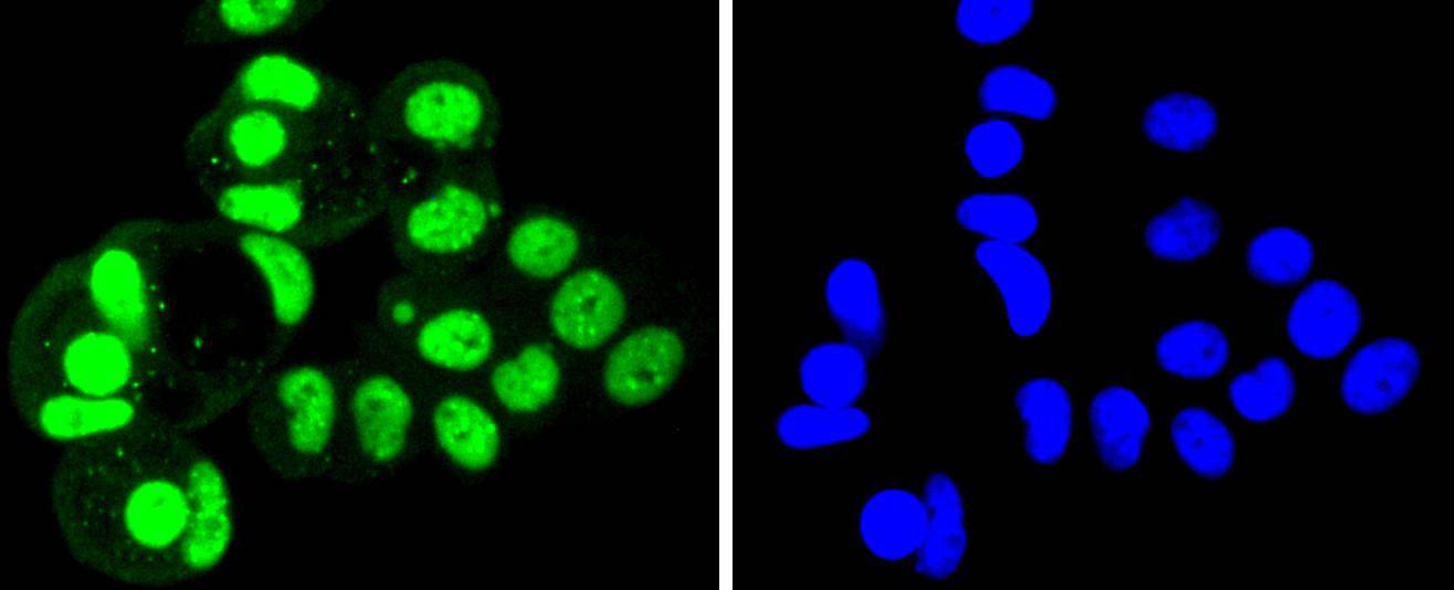 SUMO4 Rabbit mAb