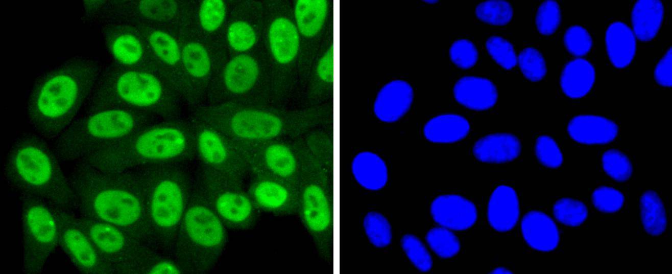 SUMO4 Rabbit mAb