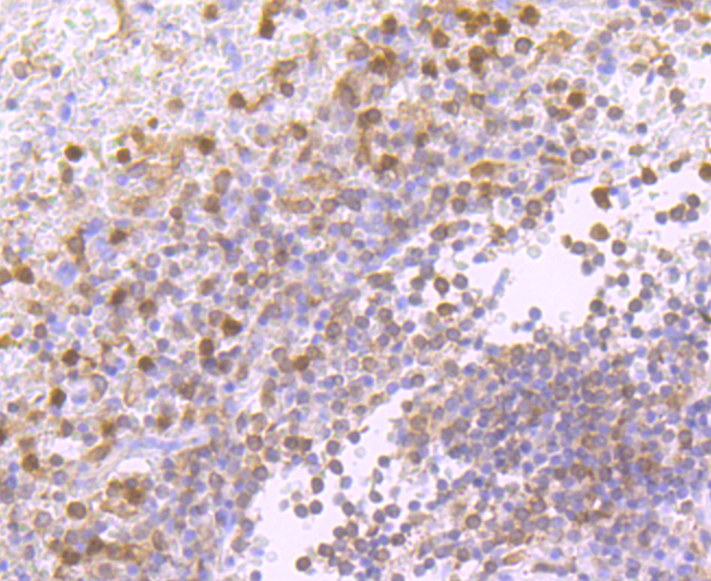 PKC delta Rabbit mAb