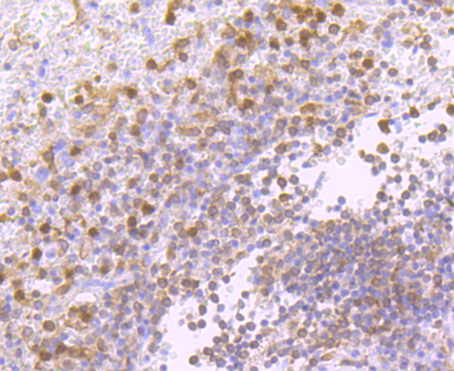 PKC delta Rabbit mAb - SAB | Signalway Antibody