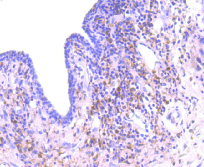 PKC delta Rabbit mAb