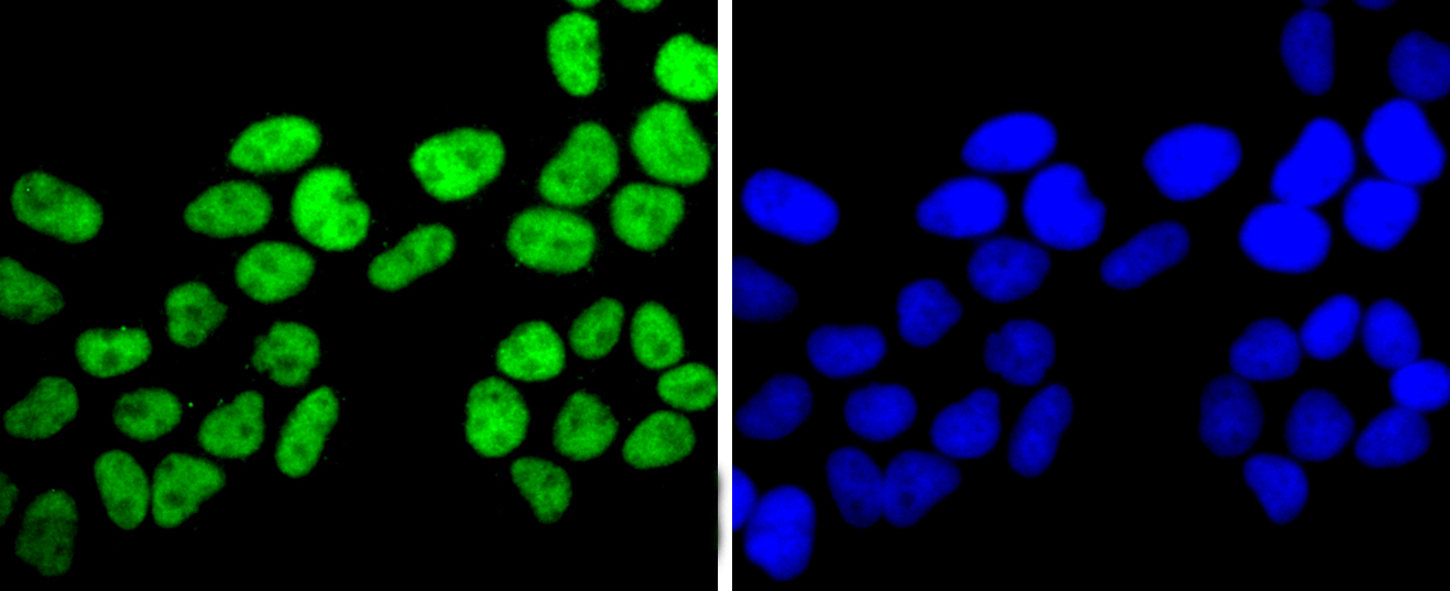 FUS/TLS Rabbit mAb