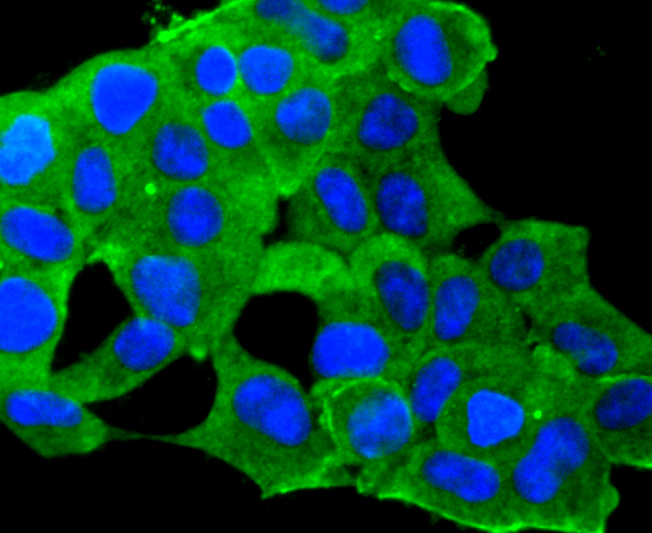 IGF2 Rabbit mAb