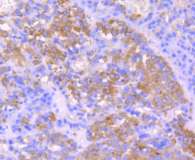 IGF2 Rabbit mAb