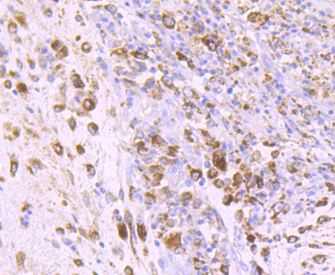 IGF2 Rabbit mAb