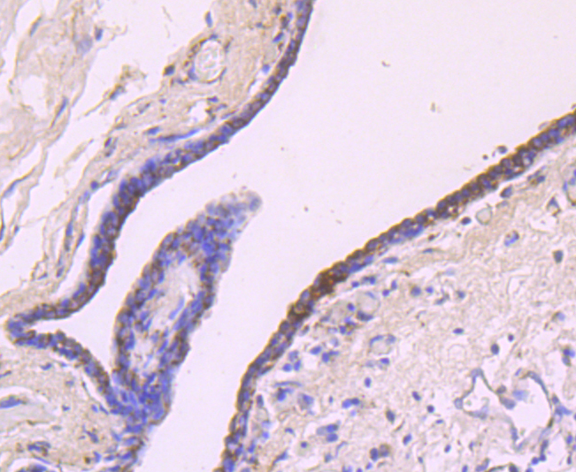 IGF2 Rabbit mAb