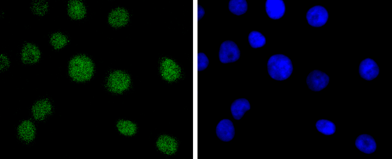 Bmi1 Rabbit mAb