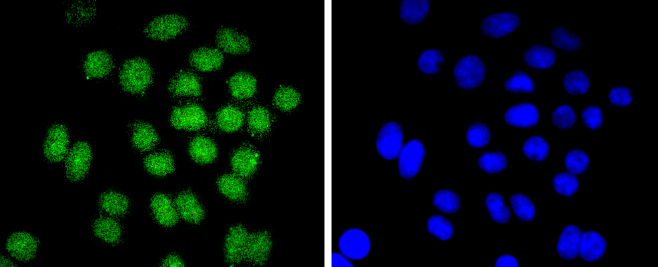 Bmi1 Rabbit mAb