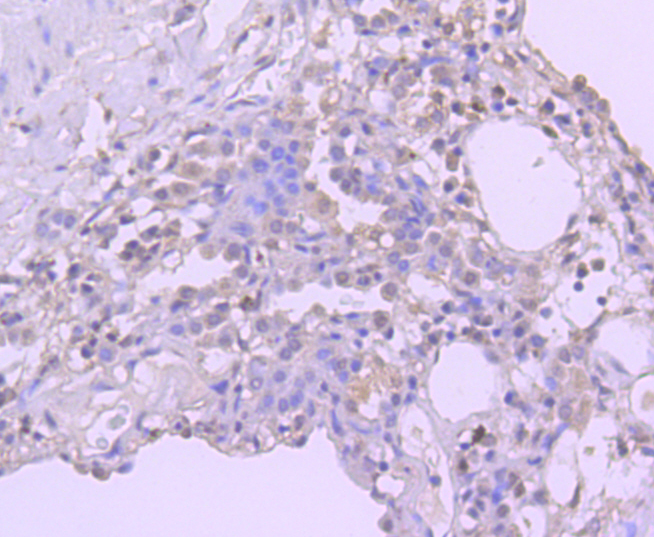 Bmi1 Rabbit mAb