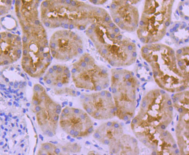 Ubiquitin D Rabbit mAb
