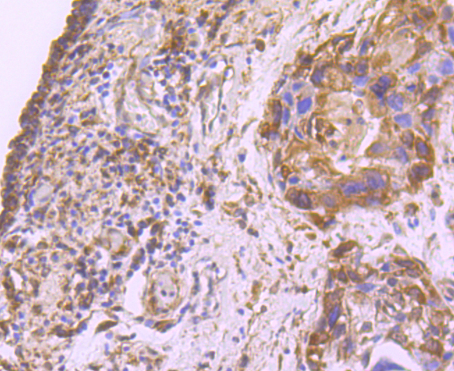Fatty Acid Synthase Rabbit mAb